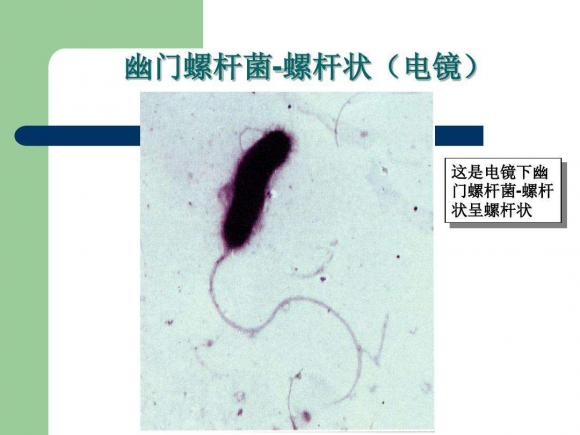 幽门螺旋杆菌为什么总治不好？一定是忽视了这个关键点！