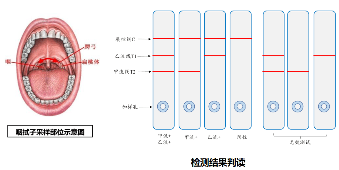 流感病毒来势汹汹，是不是感染了甲流？如何检测，一文读懂！ (图3)